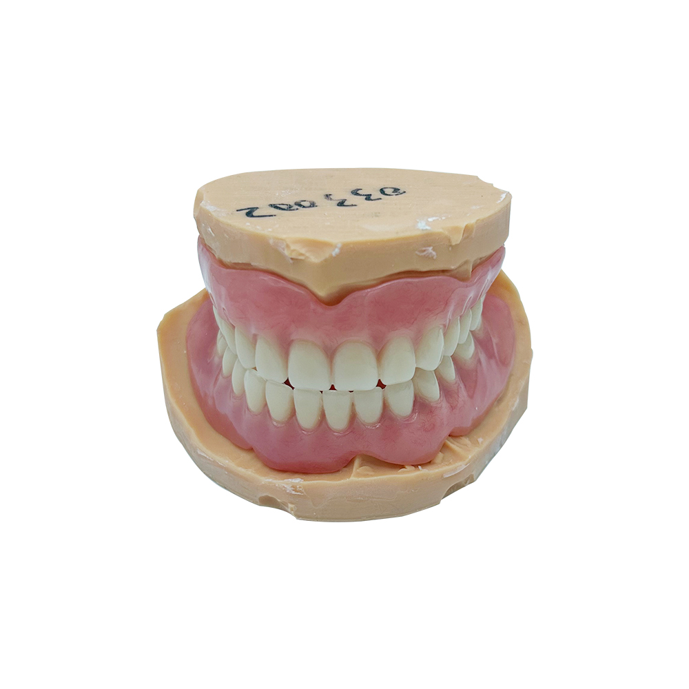 Prótesis dental completa sobre un modelo dental