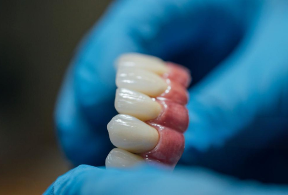 Finished dental crowns under quality inspection
