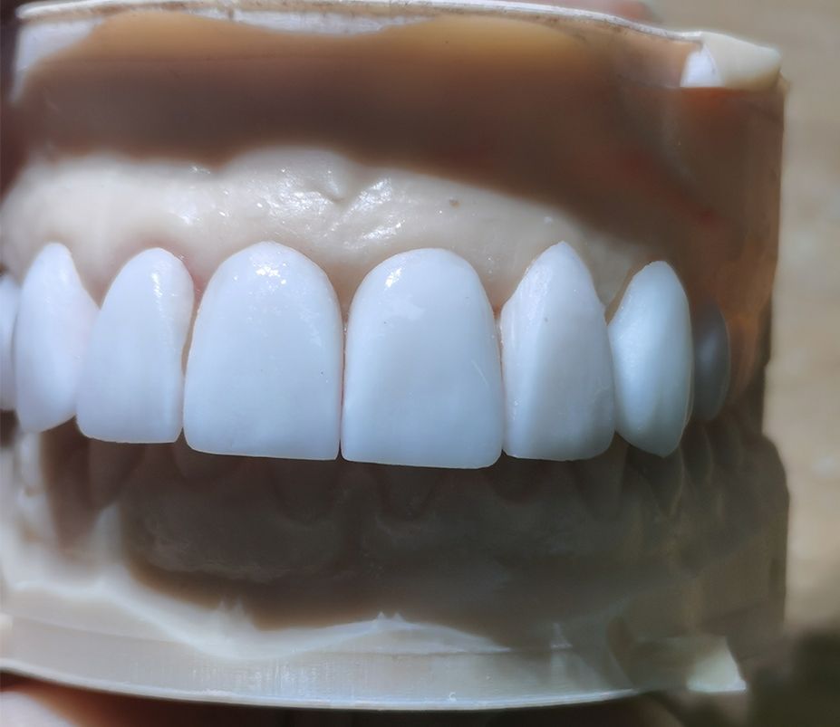 Modelos de restauración dental en un laboratorio dental