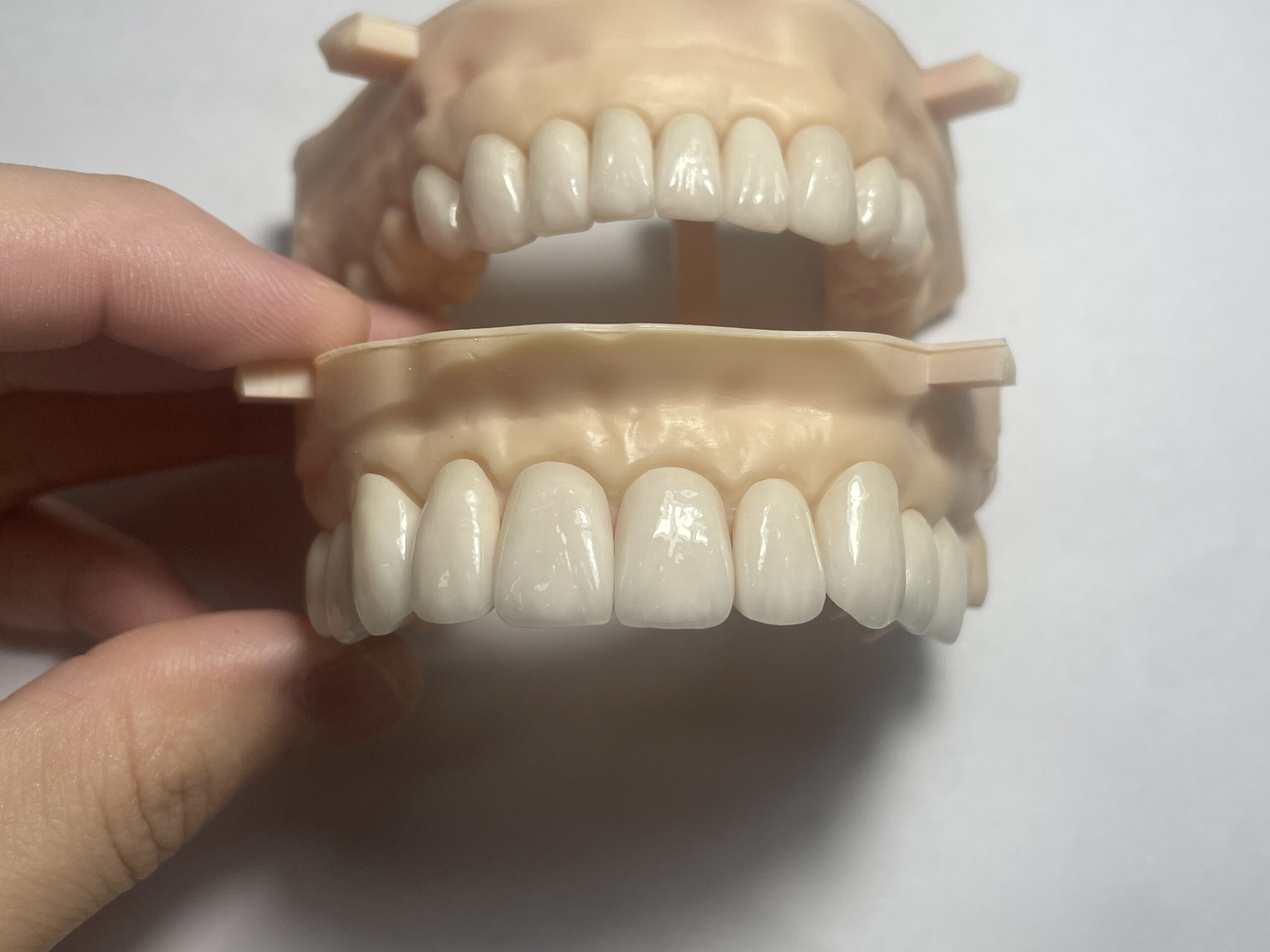 Dental bridge restoration held for quality inspection