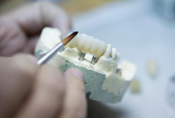 Dental technician finishing a restoration by hand