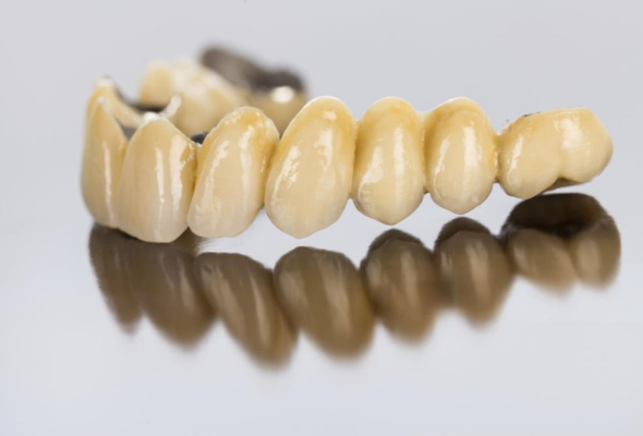 Restauração de ponte dentária de zircônia